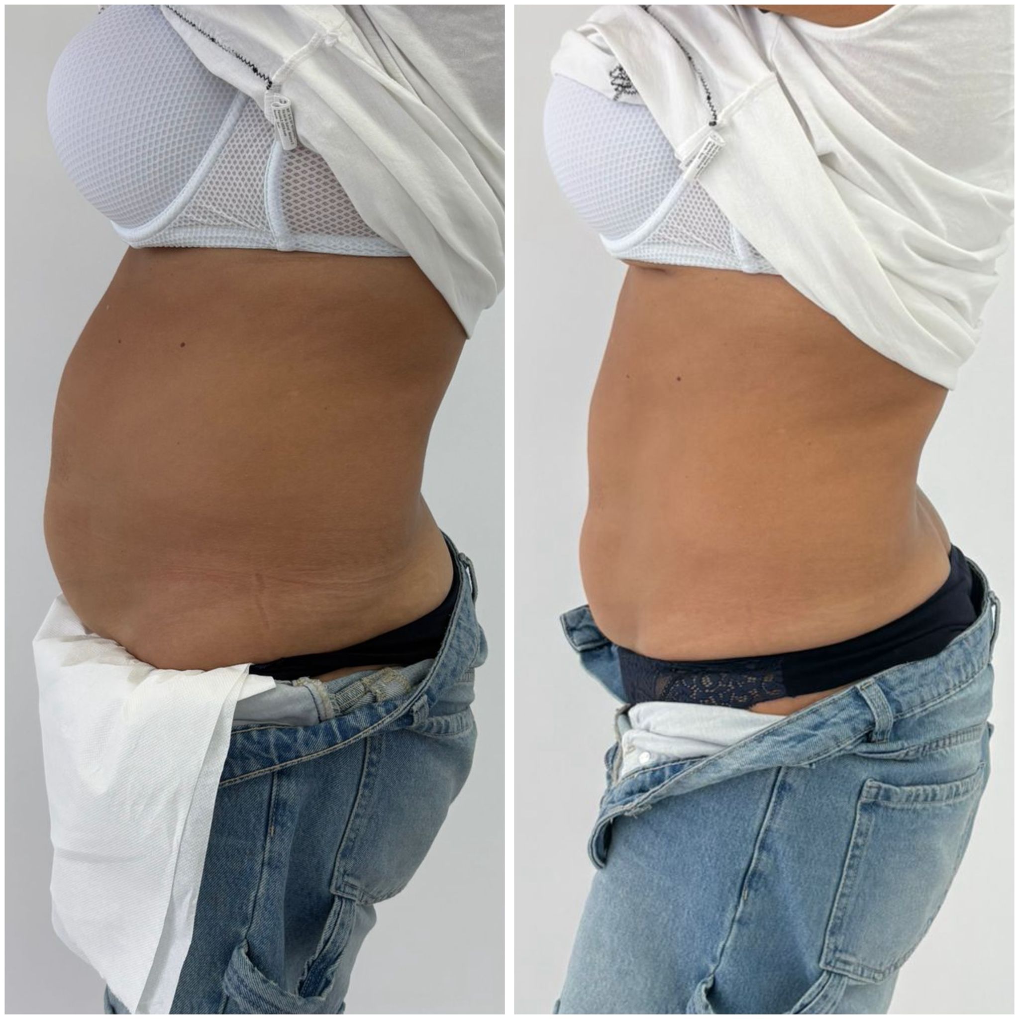 Instalare echipament